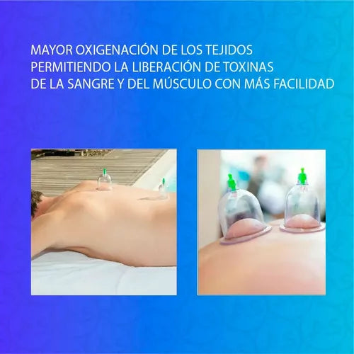 Set Vacumterapia X12 Piezas Ventosas